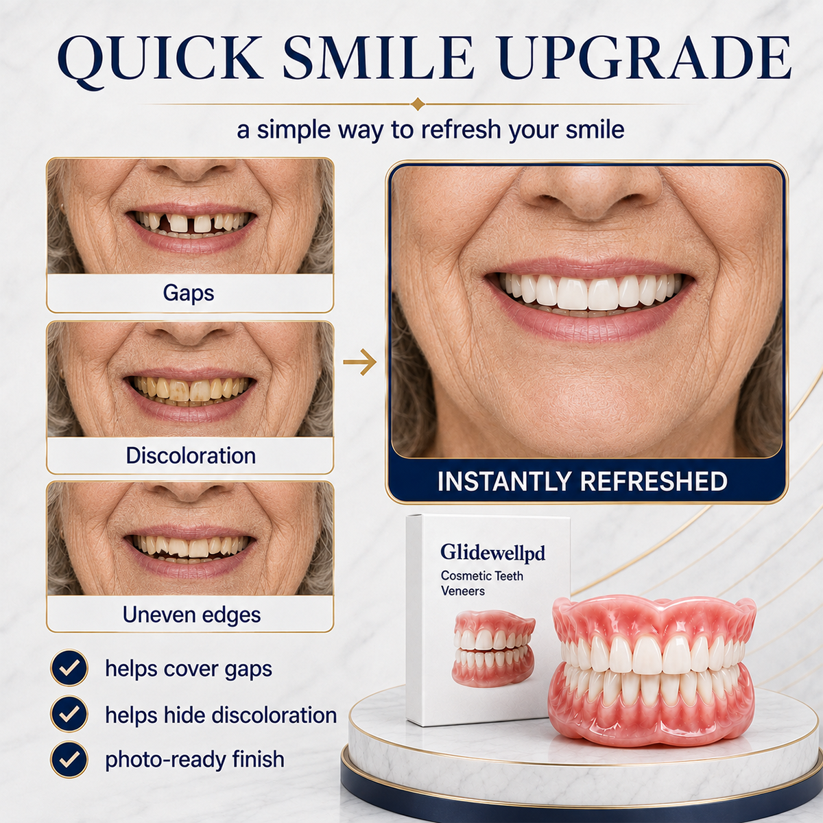 Natural-Looking Full-Cover Cosmetic Dentures
